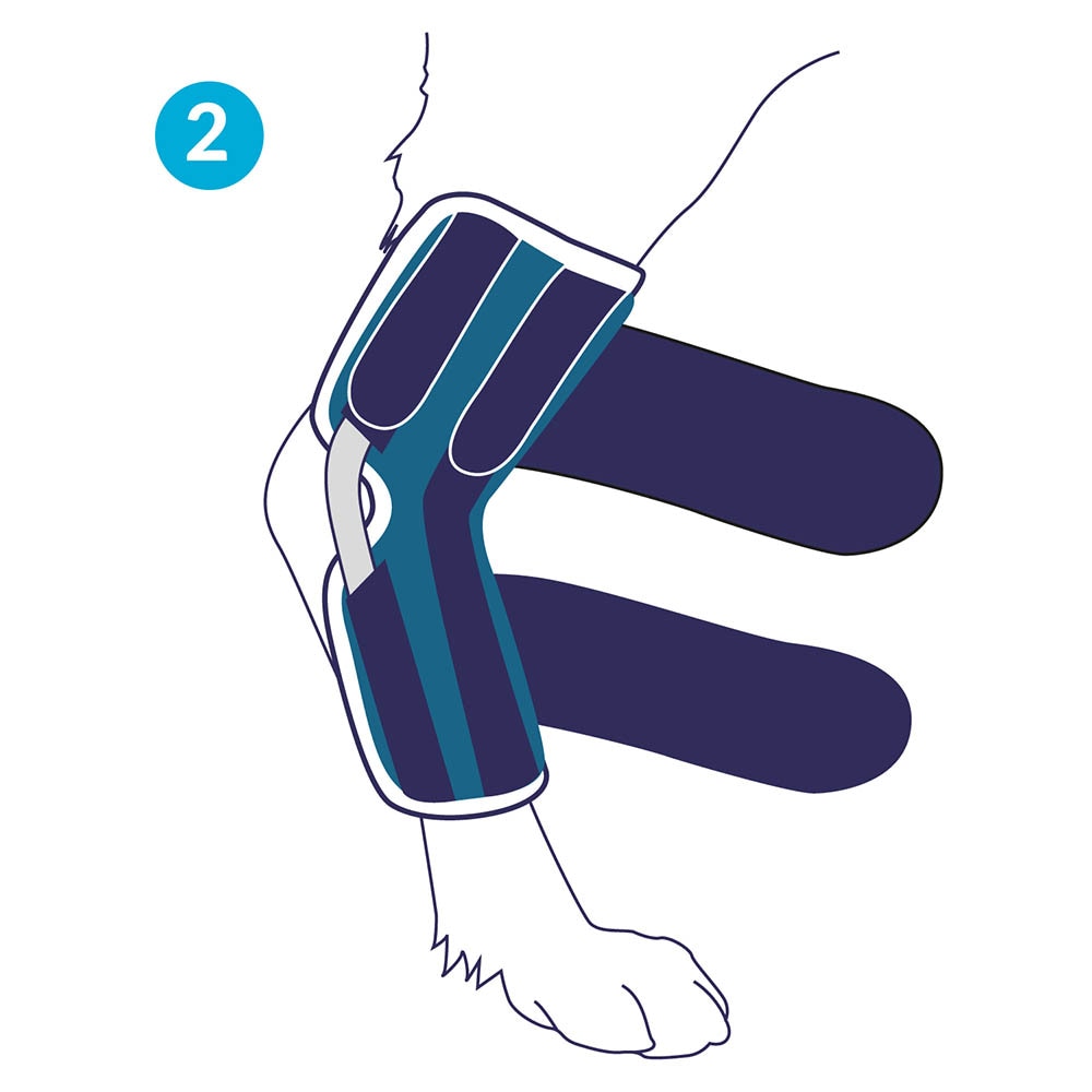 Balto Rehab-Orthese BT Hock_3