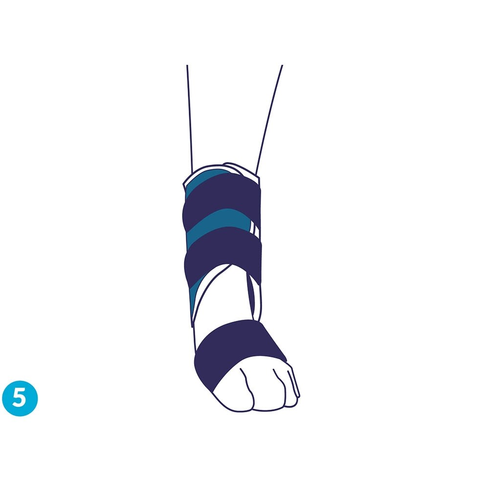 Balto Rehab-Orthese BT Splint _8